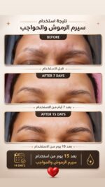 YKR Serum for Eyelashes & Eyebrows 20ml - Image 4